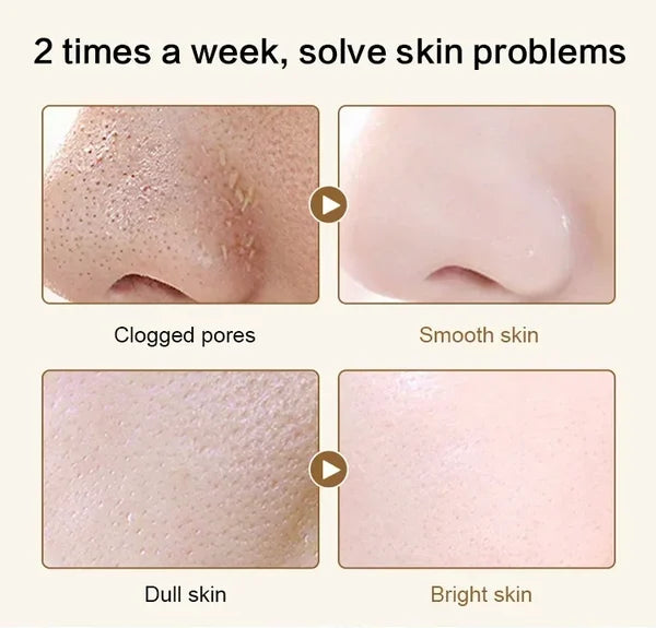 Last Day Of Discount 🔥 Gold Collagen Mask