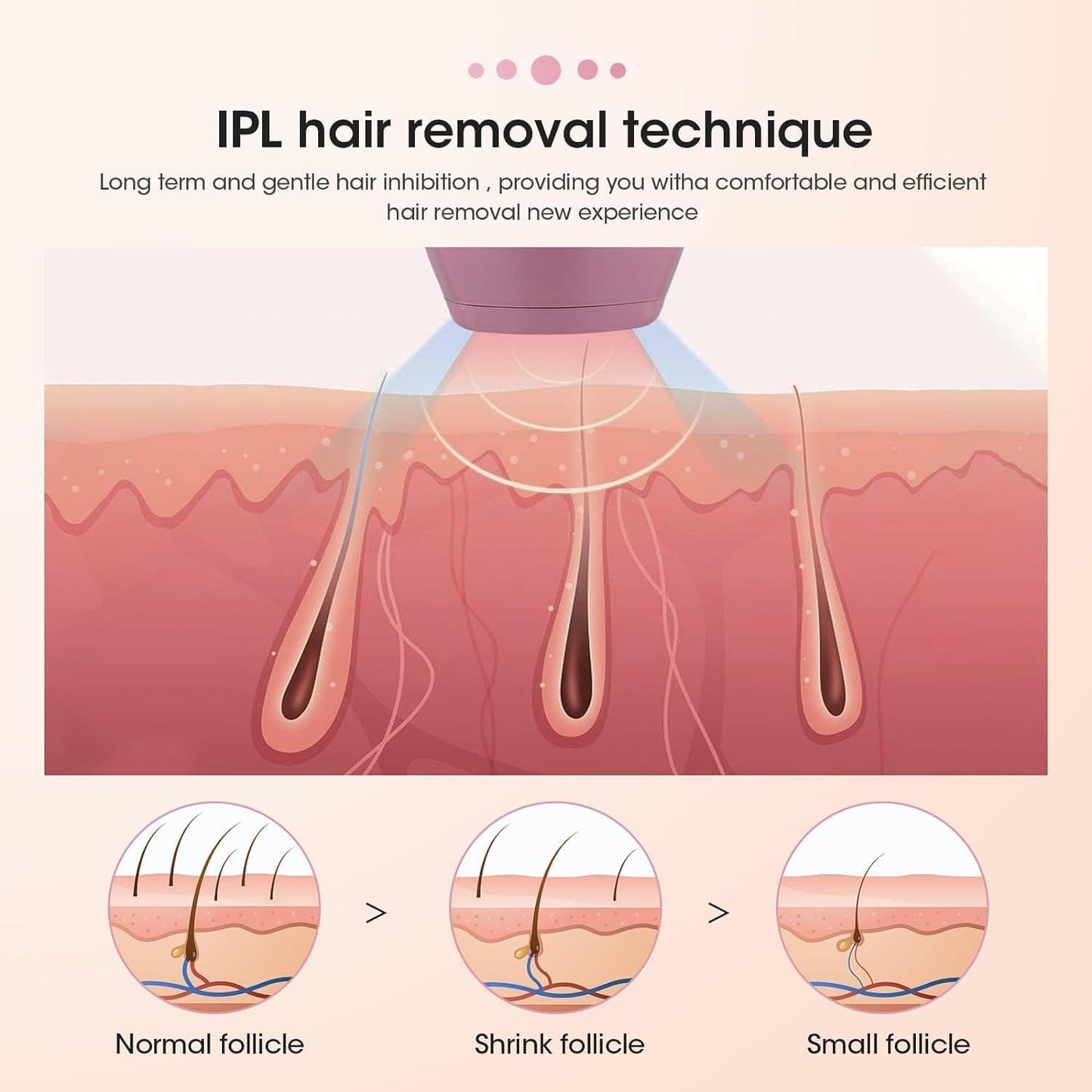 Last Day of Sale 🔥🔥🔥 Mini Laser Hair Remover