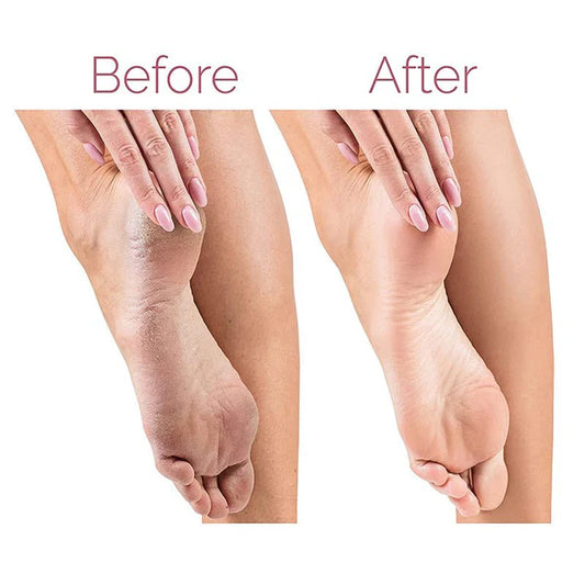 Electric Pedicure